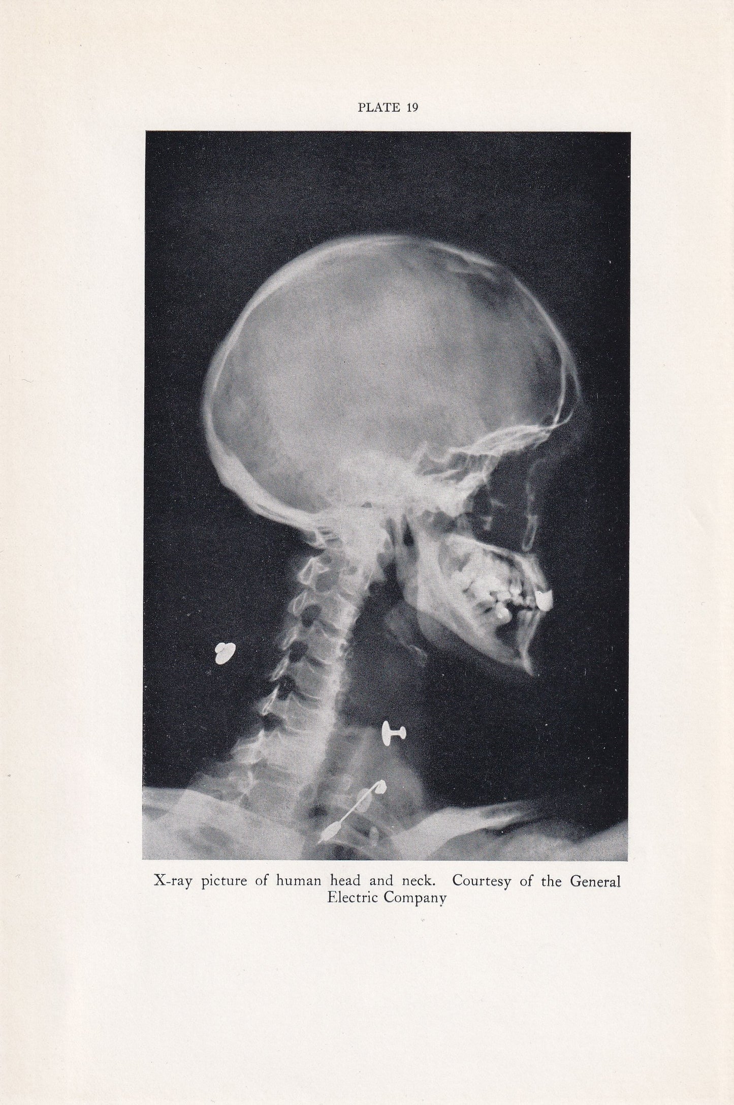 1934 X-RAY HEAD & NECK Print - Original Vintage Print - Anatomy Wall Art - Skull Wall Art - 89 Years Old - 9.15 x 6 Inches