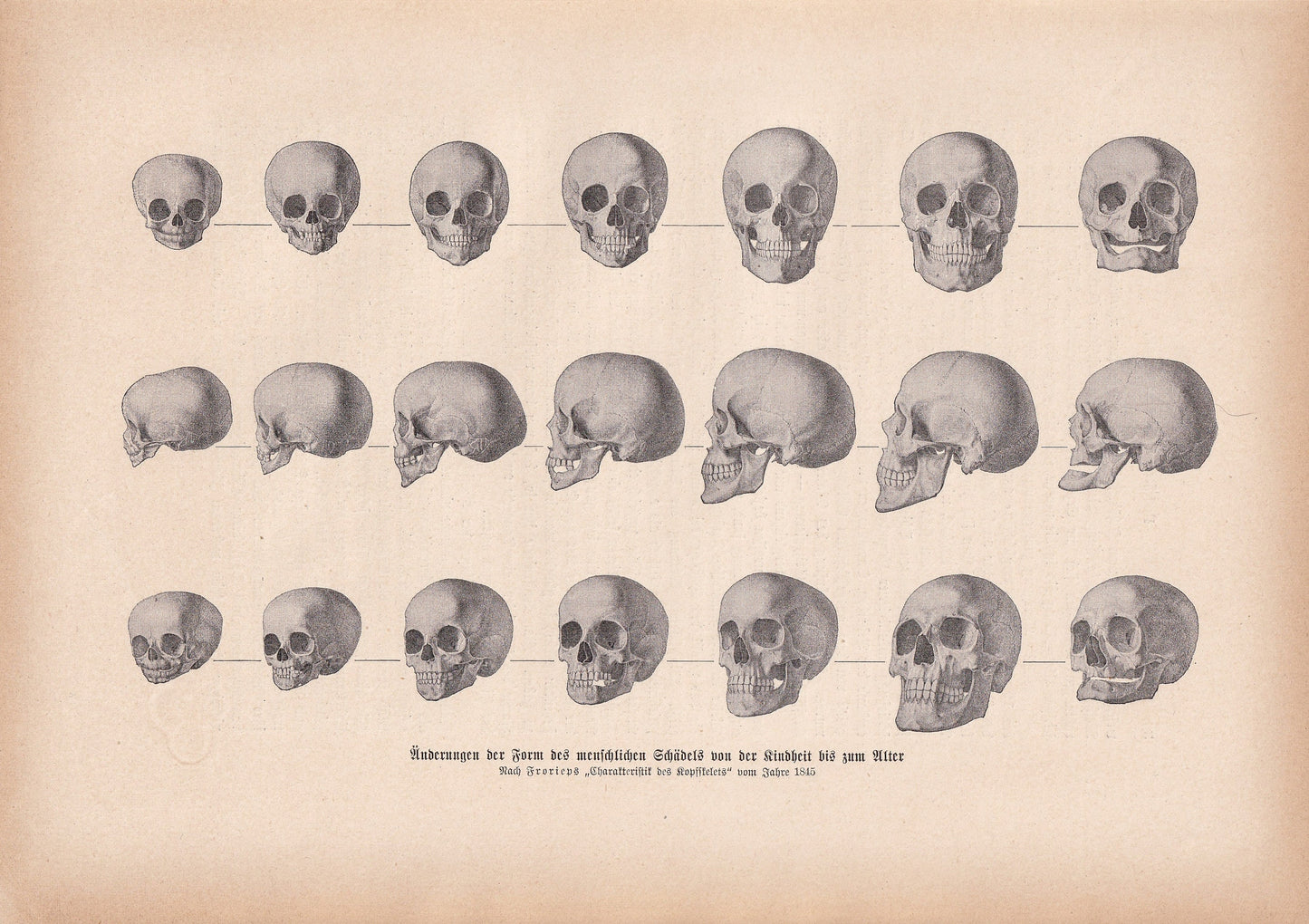 1900 SKULLS Print - Human Skulls Print - Human Anatomy Print - Halloween Print - Gothic Print - 124 Years Old - 11.2 x 7.75 Inches