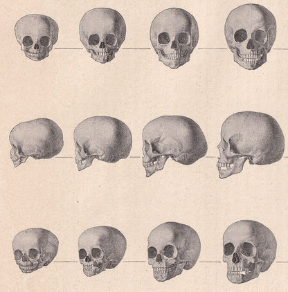 1900 SKULLS Print - Human Skulls Print - Human Anatomy Print - Halloween Print - Gothic Print - 124 Years Old - 11.2 x 7.75 Inches