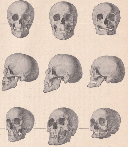 1900 SKULLS Print - Human Skulls Print - Human Anatomy Print - Halloween Print - Gothic Print - 124 Years Old - 11.2 x 7.75 Inches