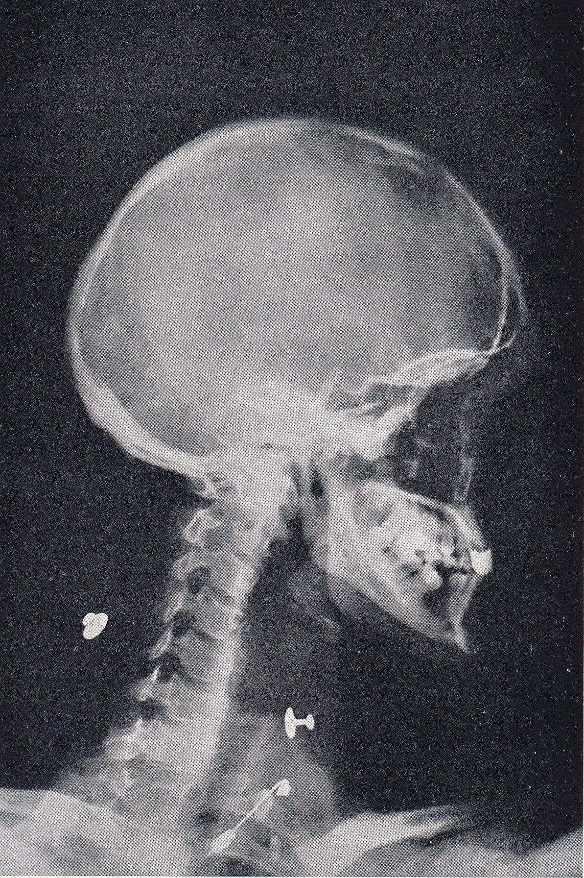 1934 X-RAY HEAD & NECK Print - Original Vintage Print - Anatomy Wall Art - Skull Wall Art - 89 Years Old - 9.15 x 6 Inches