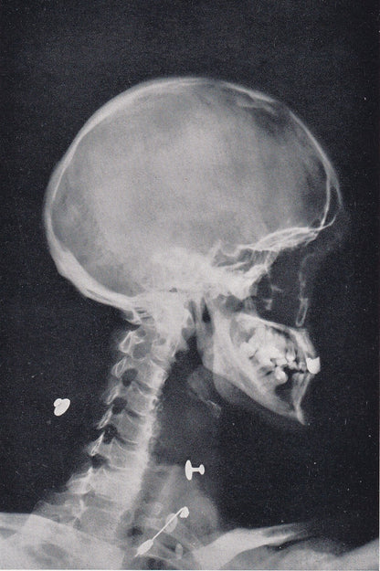 1934 X-RAY HEAD & NECK Print - Original Vintage Print - Anatomy Wall Art - Skull Wall Art - 89 Years Old - 9.15 x 6 Inches