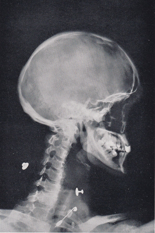 1934 X-RAY HEAD & NECK Print - Original Vintage Print - Anatomy Wall Art - Skull Wall Art - 89 Years Old - 9.15 x 6 Inches