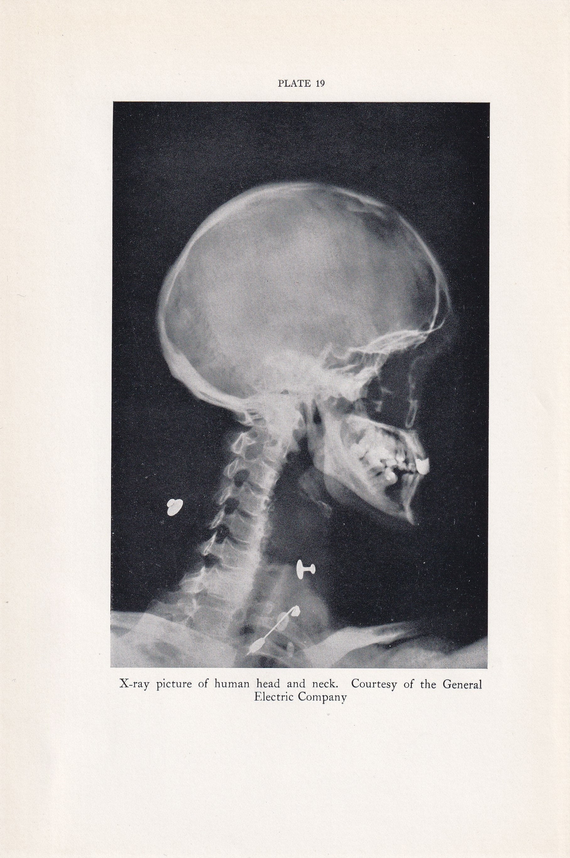 1934 X-RAY HEAD & NECK Print - Original Vintage Print - Anatomy Wall Art - Skull Wall Art - 89 Years Old - 9.15 x 6 Inches