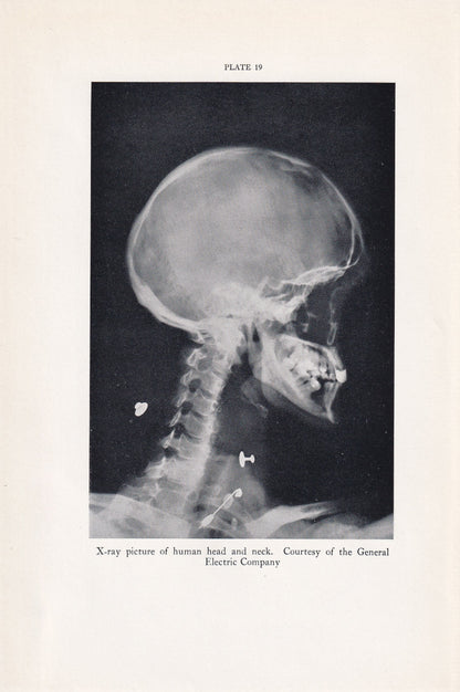 1934 X-RAY HEAD & NECK Print - Original Vintage Print - Anatomy Wall Art - Skull Wall Art - 89 Years Old - 9.15 x 6 Inches