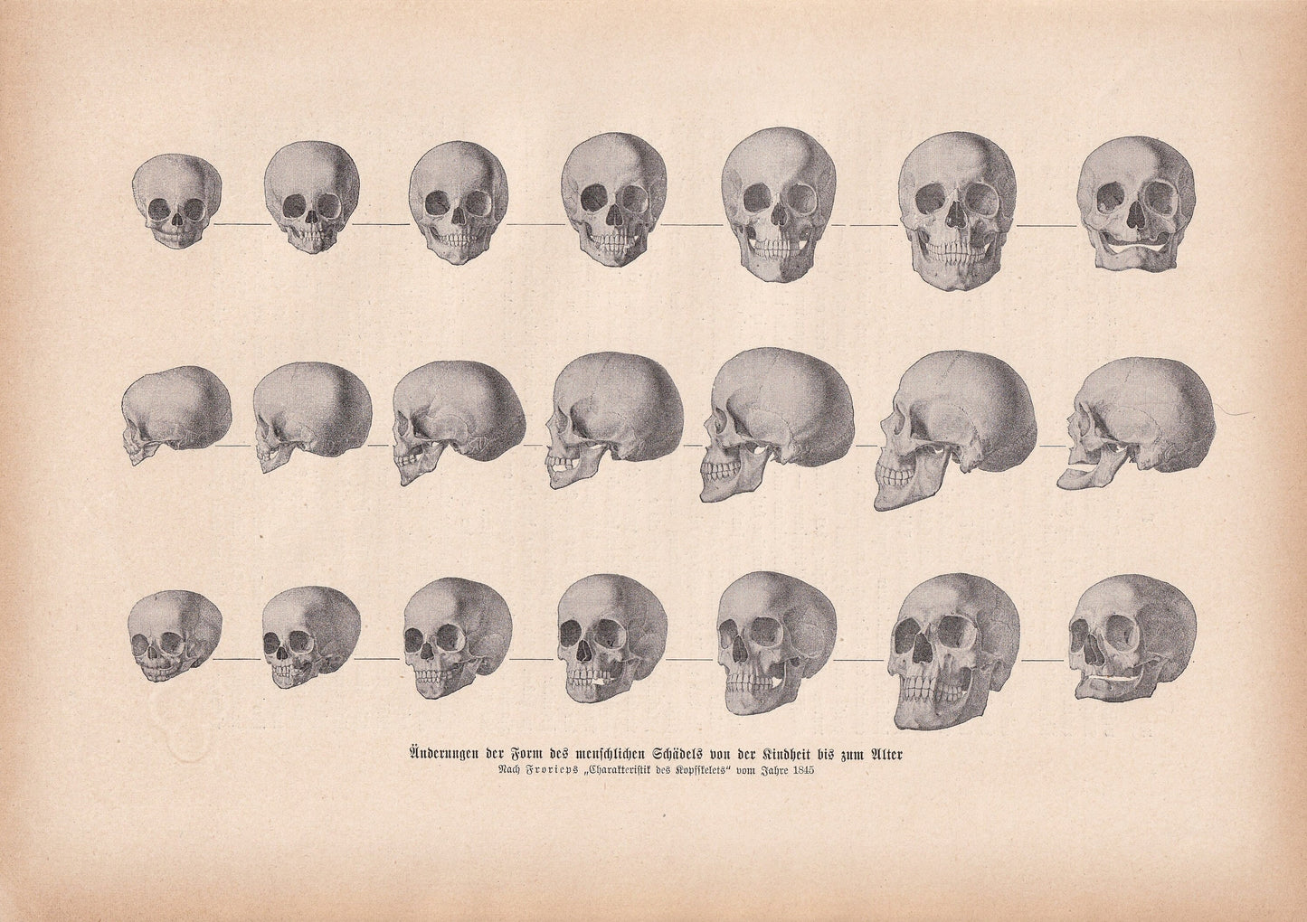 1900 SKULLS Print - Human Skulls Print - Human Anatomy Print - Halloween Print - Gothic Print - 124 Years Old - 11.2 x 7.75 Inches