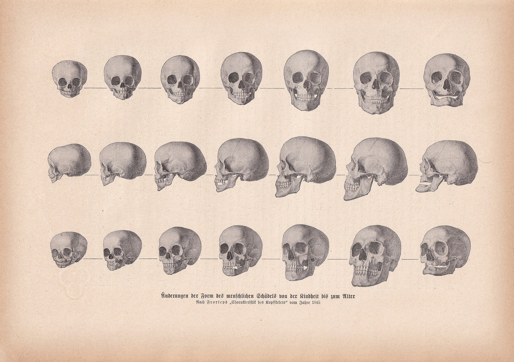 1900 SKULLS Print - Human Skulls Print - Human Anatomy Print - Halloween Print - Gothic Print - 124 Years Old - 11.2 x 7.75 Inches