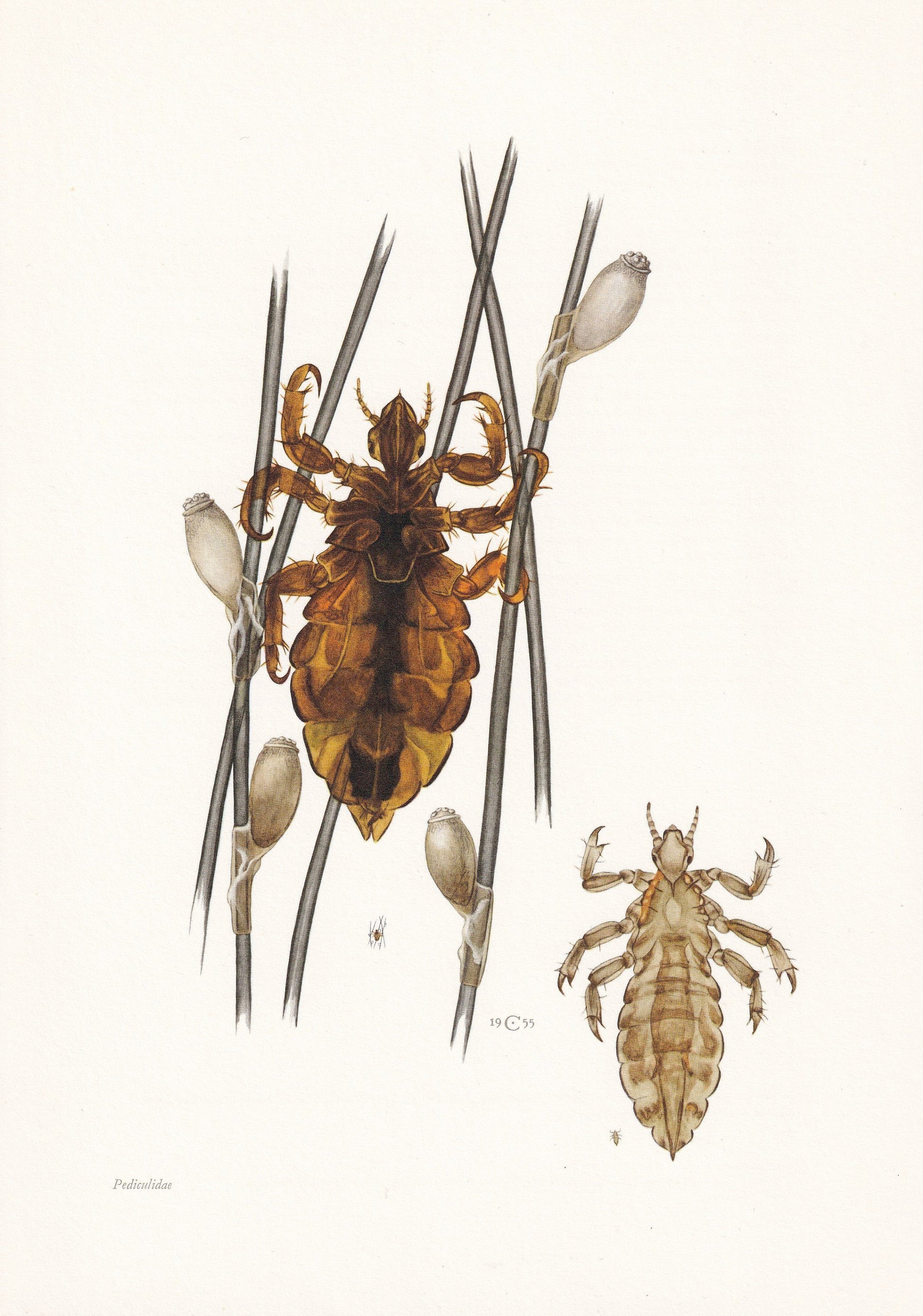 1960 HEAD LICE & Body Lice Print - Vintage Insect Print - Bugs Illustration - Insect Wall Art - Vintage Entomology Print - 63