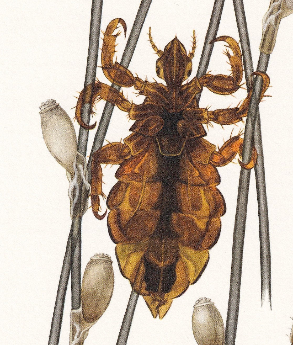 1960 HEAD LICE & Body Lice Print - Vintage Insect Print - Bugs Illustration - Insect Wall Art - Vintage Entomology Print - 63