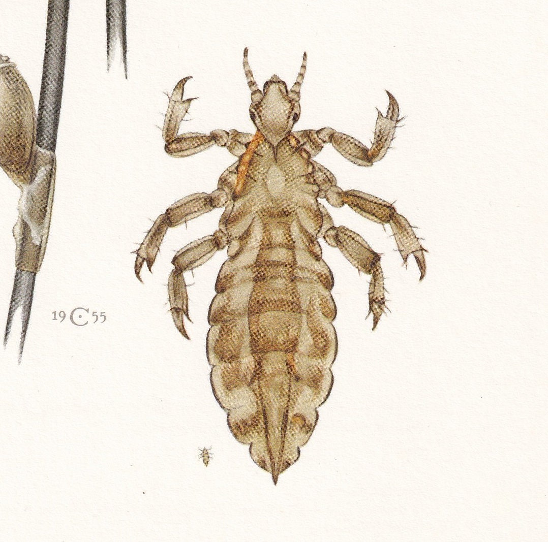 1960 HEAD LICE & Body Lice Print - Vintage Insect Print - Bugs Illustration - Insect Wall Art - Vintage Entomology Print - 63