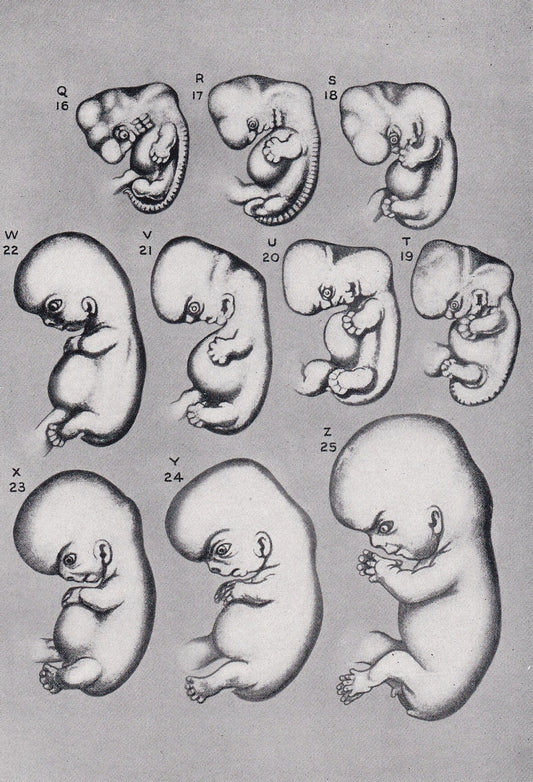 1934 HUMAN EMBRYO Print - Pregnancy Print - Original Vintage Print - Baby Print - Medical - Mother's Day - 89 Years Old - 9.1