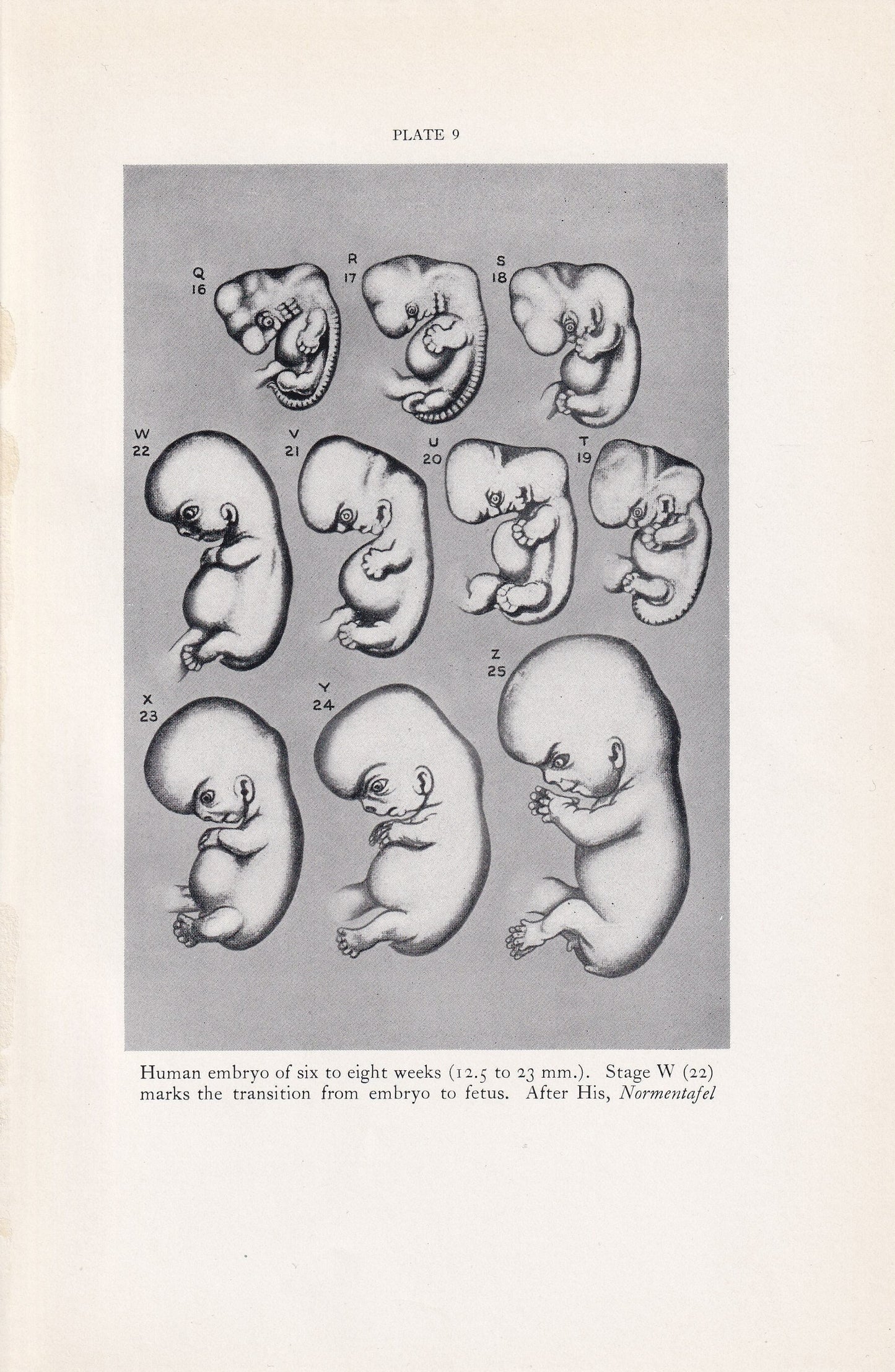 1934 HUMAN EMBRYO Print - Pregnancy Print - Original Vintage Print - Baby Print - Medical - Mother's Day - 89 Years Old - 9.1
