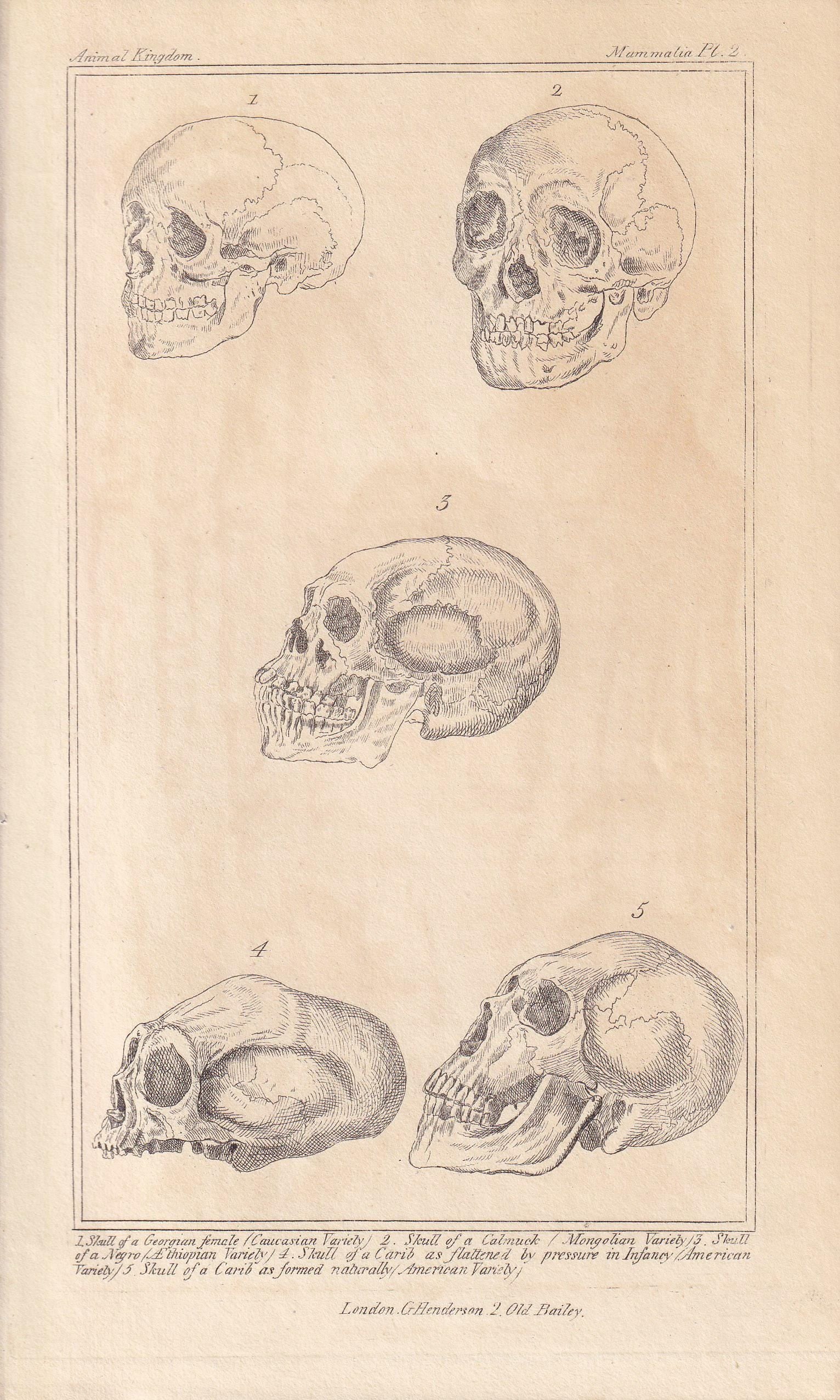 1834 HUMAN SKULLS Print - Hand-Coloured Antique - Cuvier - Anatomy Medicine Wall Art - Orthopaedic Gift Decor - Halloween - 5.3 x 8.2 Inches