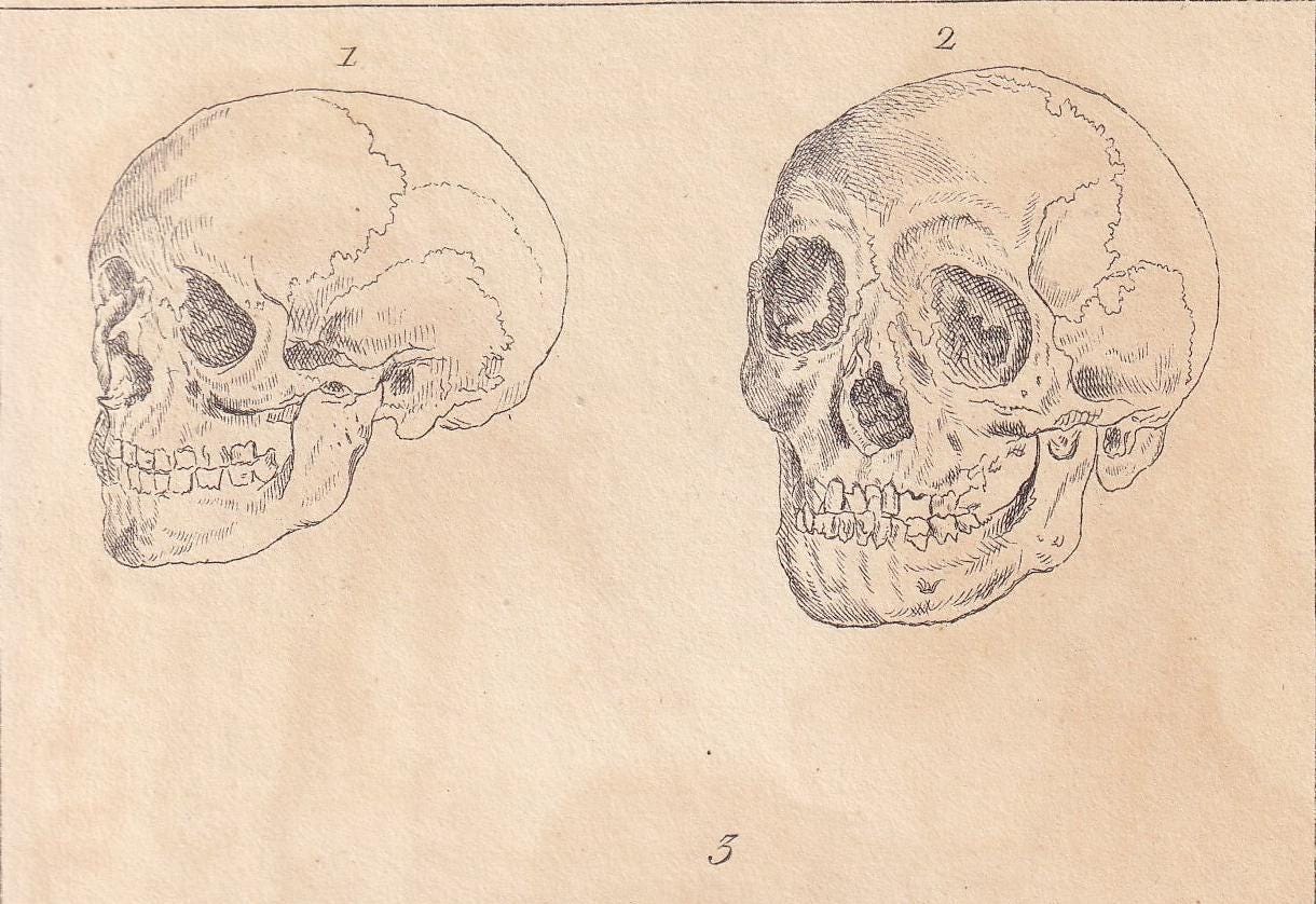 1834 HUMAN SKULLS Print - Hand-Coloured Antique - Cuvier - Anatomy Medicine Wall Art - Orthopaedic Gift Decor - Halloween - 5.3 x 8.2 Inches