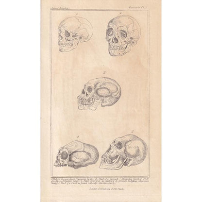 1834 HUMAN SKULLS Print - Hand-Coloured Antique - Cuvier - Anatomy Medicine Wall Art - Orthopaedic Gift Decor - Halloween - 5.3 x 8.2 Inches